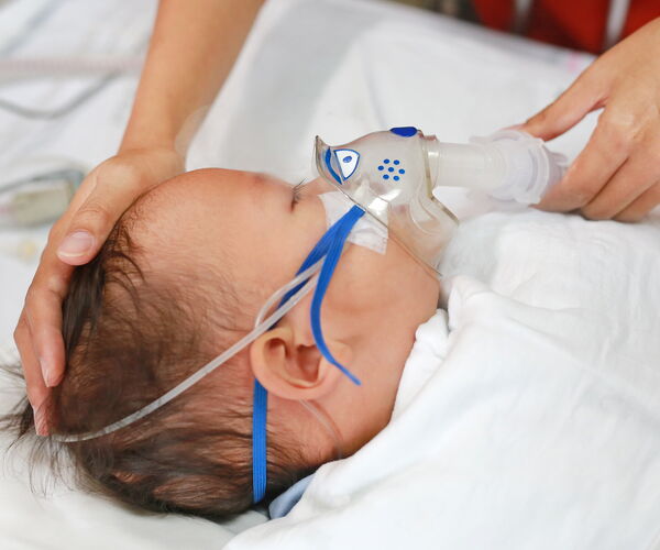Sleeping baby with brown hair lies on white fabric, wearing an oxygen mask with blue straps, hands gently holding the head and mask.