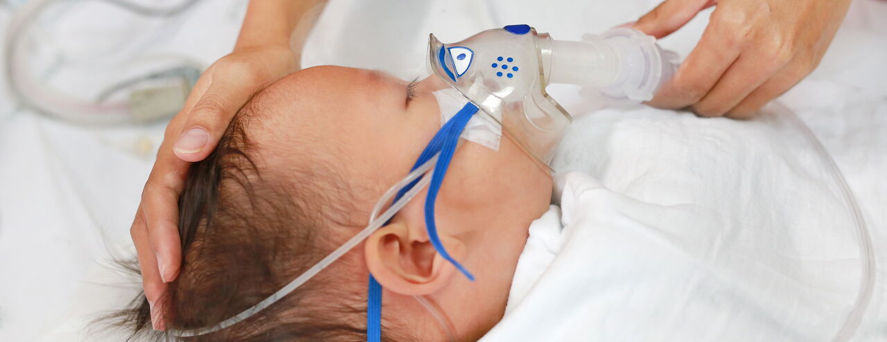 Sleeping baby with brown hair lies on white fabric, wearing an oxygen mask with blue straps, hands gently holding the head and mask.